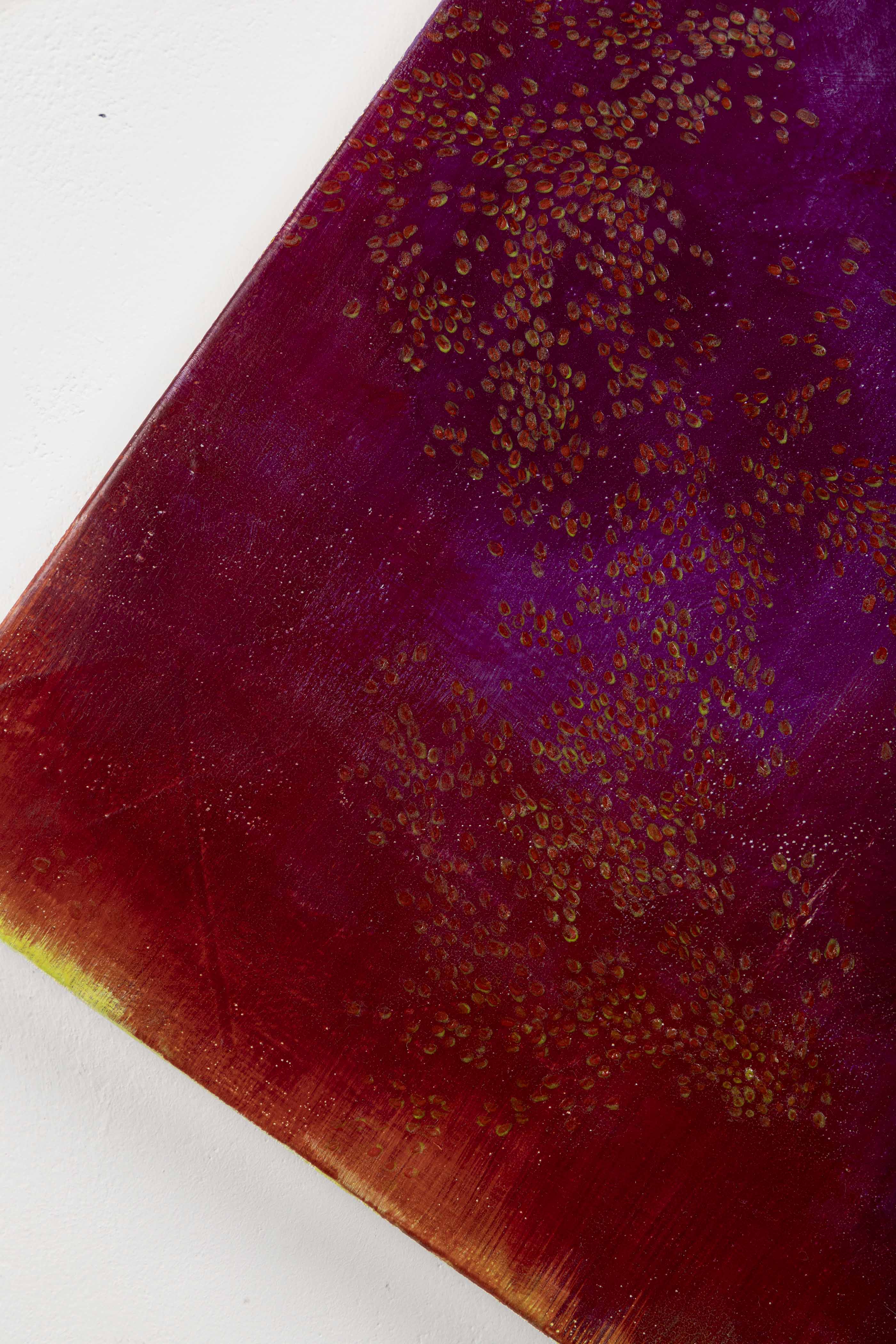 제가 사랑니를 빼서 말을 못해요.