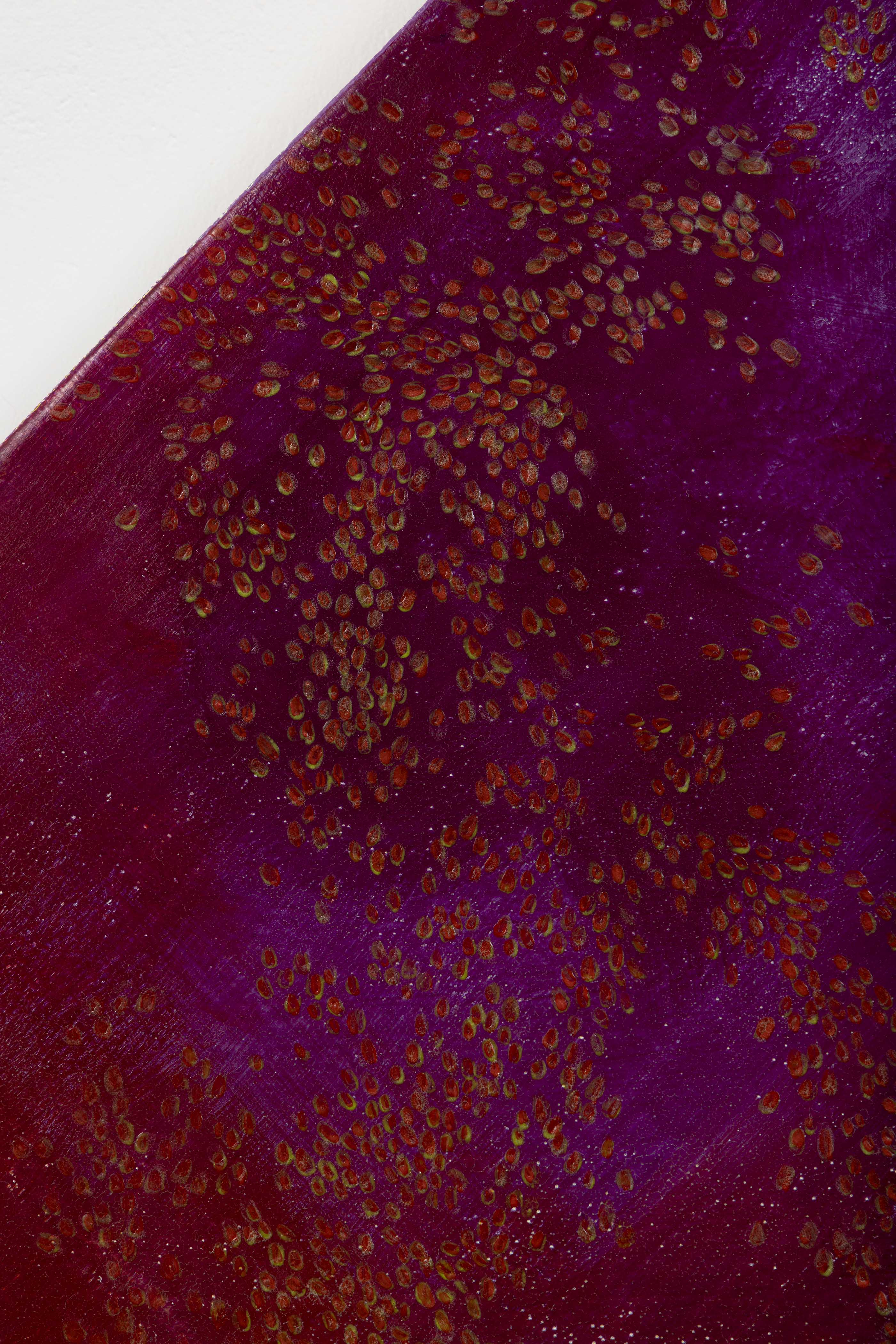 제가 사랑니를 빼서 말을 못해요.