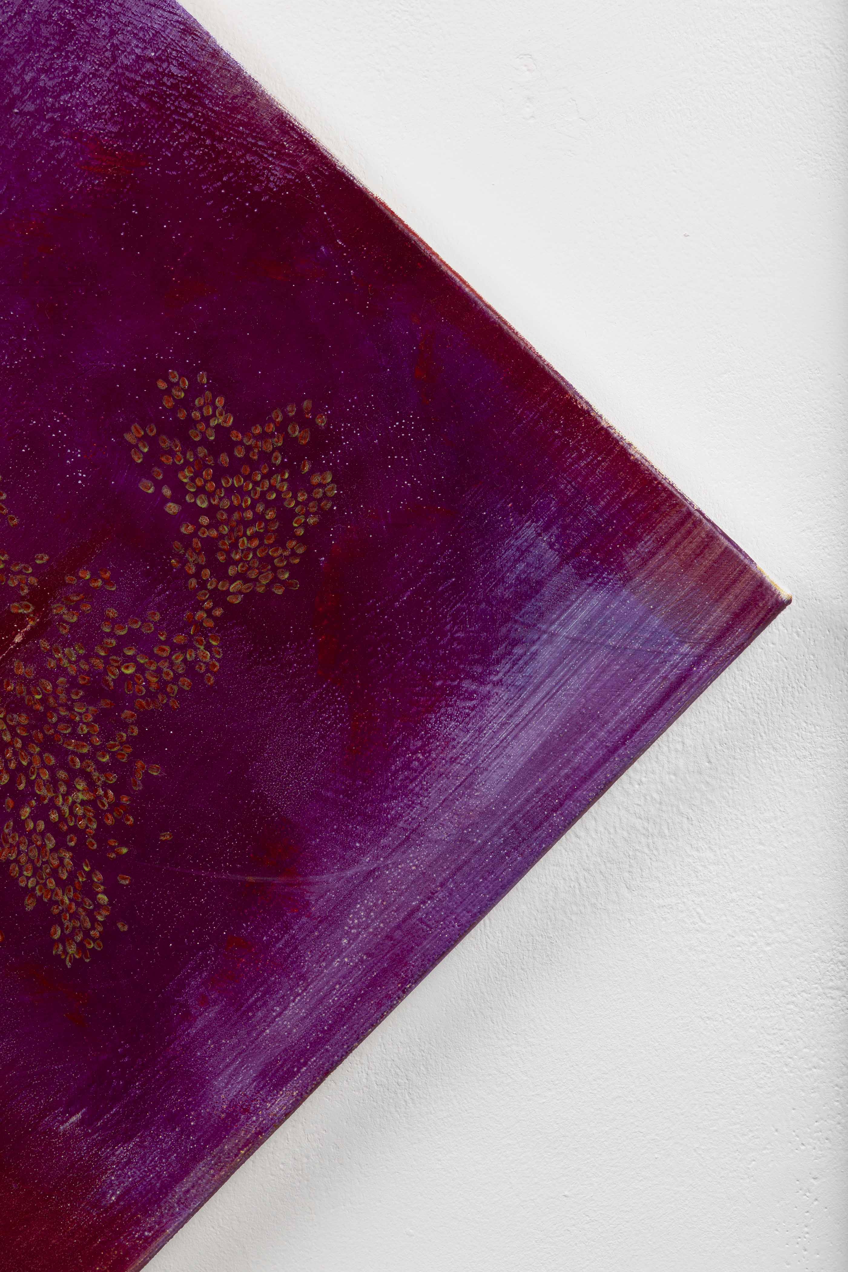 제가 사랑니를 빼서 말을 못해요.